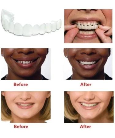 Buy Presses Fake Teeth - Carnival Veneers for Men & Women | Bad Tooth Whitening Alternative - Buy Online on GoSupps.com