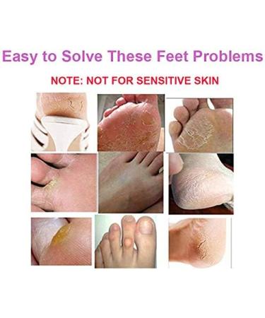 Exfoliating Foot Peel Mask - 2 Pairs | Remove Dead Skin in 3-7 Days | Lavender Scented Foot Mask for Soft Feet - Buy Online on GoSupps.com