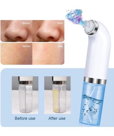 Electric Blackhead and Acne Remover Kit Rechargeable and Adjustable Tool with USB Specifications Professional Grade - Buy Online on GoSupps.com