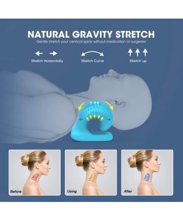 Pain Relief Kit: Neck Stretcher Cloud, Posture Corrector for Men & Women - Cervical Traction Device, Back Brace for Spine Alignment, Shoulder Support - Neck, Back, Shoulder Pain Relief - Buy Online on GoSupps.com