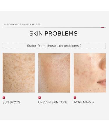 Niacinamide Skincare Set - Hydrate & Even Skin Tone | Travel-Friendly 4pcs Kit for Women Moms & Teens - Perfect Birthday Gift - Buy Online on GoSupps.com