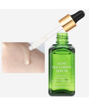 Natural Acne Treatment Essence - Tea Latte Extract | Pore Reducer | 17ml Mild & Non-Fatty Formula - Buy Online on GoSupps.com