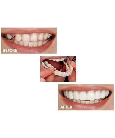Buy 2 Pairs of Cosmetic Dentures - Instant Veneers & Temporary Teeth for Perfect Smile | Comfortable Fit - Buy Online on GoSupps.com