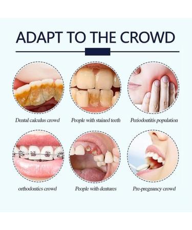 Miyanxi Tooth Powder Probiotics Swift White Tooth Powder Miyanxi Teeth Whitening Effectively Remove Coffee Stains Smoking Fresh Breath (Color : 2) - Buy Online on GoSupps.com