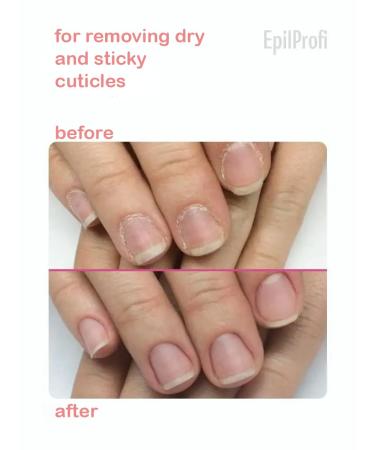 SOS Manicure Cuticle Remover Cream - Professional 1 Oz | Best for Nail Care & Grooming - Buy Online on GoSupps.com