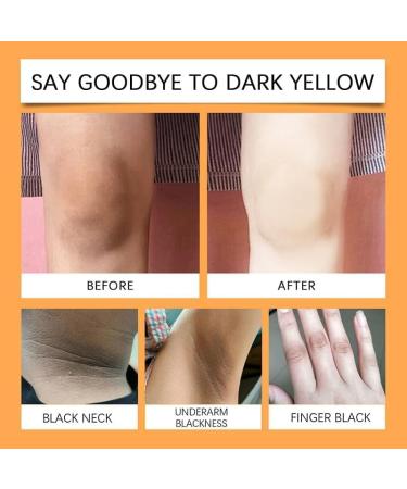 Ikallant Vitamin C Body Cream 5 Vitamins C Natural Moisturizing and Lightening Makeup Remover Lightening Cream - Buy Online on GoSupps.com