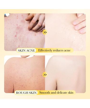 Natural Sulfur Bar Soap | Face & Body Cleanser for All Skin Types | Pore Cleaner - 4.41 Oz (Pack of 2 - Buy Online on GoSupps.com