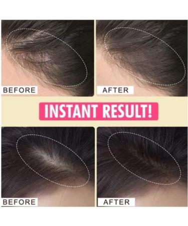 Hair Building Fibers Hairline Powder YouthColor Hair Shading Powder (1# Dark Brown) - Buy Online on GoSupps.com