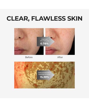 Buy Skin&LAB Glutathione Ampoule Toner 6.76 fl oz | Improve Dark Spots Hyperpigmentation Sensitive Skin | Korean Skincare - Buy Online on GoSupps.com