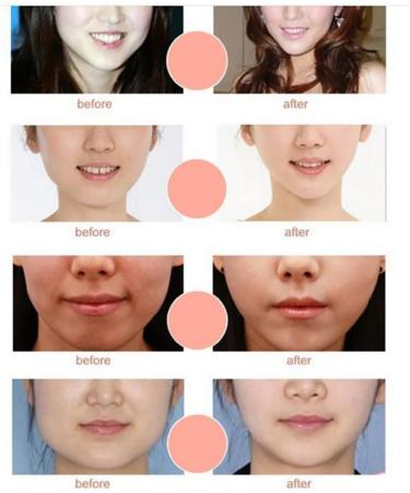 mask korean double chin slimmer 1PC Double Chin Mask Perfect V Lifting Premium Anti-celluite Mask For Facial Firming Treatment V Line Lifting 4D Face Mask Double Chin Reducer(White) - Buy Online on GoSupps.com