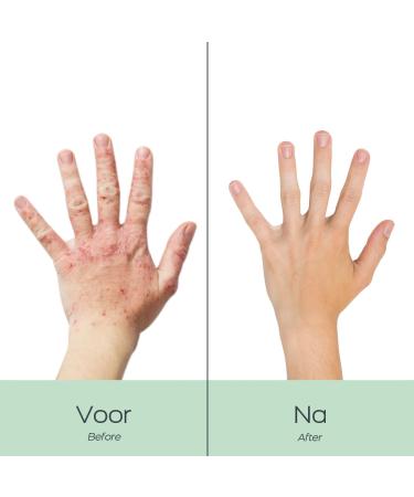 Orange Care Baba de Caracol Snail Mucus Moisture Cream - 100ml Hand Cream for Dry Hands | Nourishing & Regenerating Formula for Men & Women - Buy Online on GoSupps.com