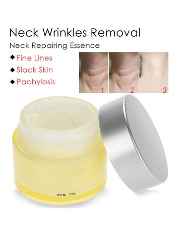100g Natural Neck Wrinkle Removal Cream | Anti-Aging Moisturizing & Firming Essence for Neck Repair - Buy Online on GoSupps.com