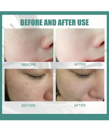 Hairline Silk Protein Skin Repair Soap - Whitening & Exfoliating (2Pcs) - Buy Online on GoSupps.com