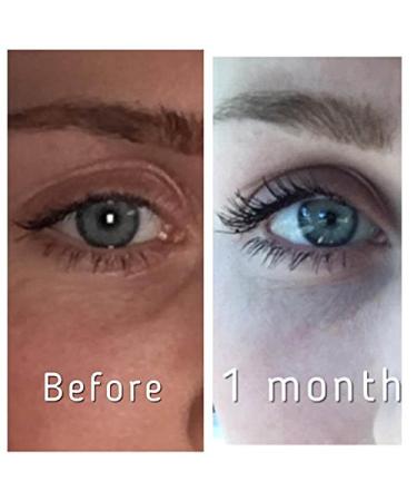 Pronexa FantastiLash Eyelash & Brow Conditioner with Castor Oil - Strengthens, Nourishes, and Protects Perfect for Healthy Eyelashes and Brows - Buy Online on GoSupps.com