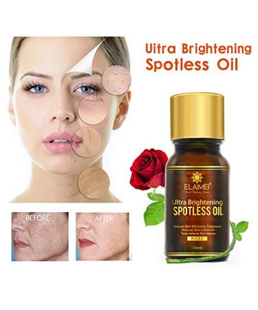 ALIVER Ultra Brightening Spotless Oil - Dark Spots, Age Spots, Hyperpigmentation, Stretch Marks - Skin Whitening Treatment - 2 Pack - Buy Online on GoSupps.com