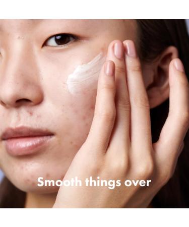 Hero Cosmetics Rescue Retinol Night Cream - Gentle Formula for Uneven Texture & Post-Blemish Marks - Safe for Sensitive Skin (30ml) - Buy Online on GoSupps.com
