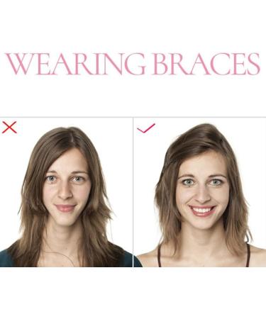 Chewie Alignment Device - Reusable Jaw-Friendly Dentation | 6-Piece Chewies for Perfect Alignment - Buy Online on GoSupps.com