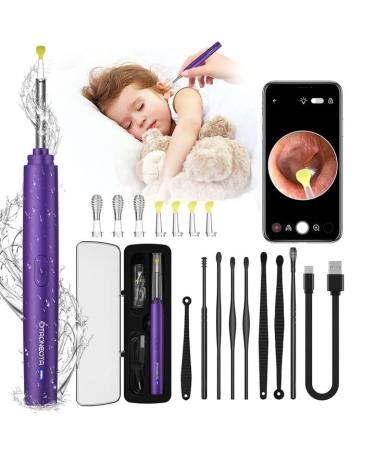 OTAONEOTA Ear Wax Removal Tool  Ear Cleaner with 1296P FHD Camera  Ear Cleaning Kit with Lights and Built-in WiFi  Compatible with iPhone  iPad  and Android(Purple)