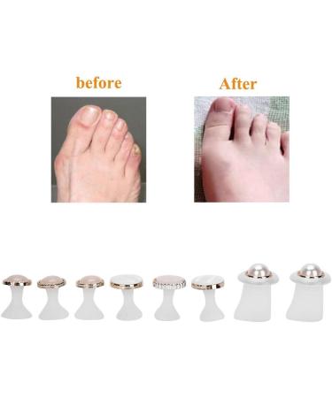 Toe Separators 8 Pcs Reusable Silicone Toe Spacers Nail Art Toe Separation Tool Pedicure Care(MY-05) - Buy Online on GoSupps.com