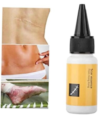 Scar Removal Cream - Acne Scar Treatment Serum for Smooth & Delicate Skin 20mL - Buy Online on GoSupps.com