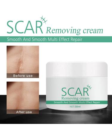 Hotiary Plant Scar Repair Cream - Acne & Stretch Mark Remover for Scars, Burns, Postoperative Skin - Men & Women - Buy Online on GoSupps.com