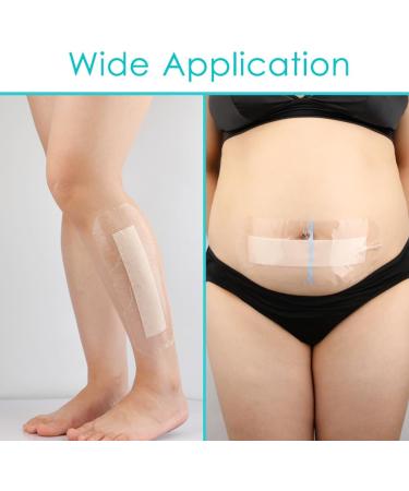 Waterproof Long Surgical Incision Bandages for Knee Replacement - Silicone Adhesive Dressing & Non-Stick Pads - Hip Wound Care Shower Patches (4x10 Inch Pack of 5 - Buy Online on GoSupps.com