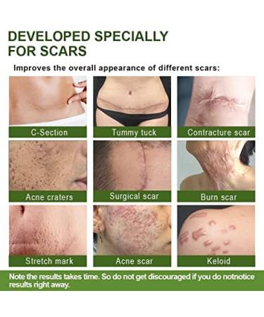 30ml Goopgen Advanced Scar Repair Serum - Medical Grade Scar Removal Cream Spray Treatment for All Scars - Buy Online on GoSupps.com