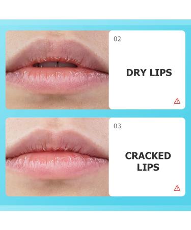 BIOAQUA Moisturizing Lip Care Gel Balm - Long Lasting Hydration & Cracked Skin Repair - Travel Friendly 10g - Buy Online on GoSupps.com