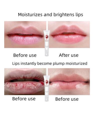 Lip Serum by Vitamin Extract Dark Lip Treatment Lip Blam for Dark Lips Smokers and Non-Smokers Vitamin E Lip Essence Protection Repair Long-Lasting Moisturizer Lip Care - Buy Online on GoSupps.com