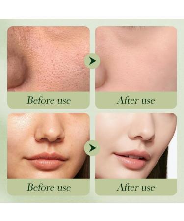 Avocado Skincare Sets 6Pcs Skincare Gift Set with Facial Cleanser Face Serum Face Cream Eye Cream Toner moisturizing Lotion Skin Care Sets & Kits Hydrating Facial Kit for women - Buy Online on GoSupps.com