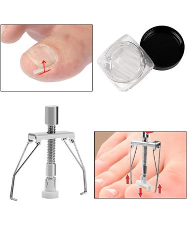 KARELLS Ingrown Toenail Correction Set Ingrown Toenails Set 12 Pieces Ingrown Toenail Lifter Ingrown Toenail Correction Treatment Set for Ingrown Toenails - Buy Online on GoSupps.com