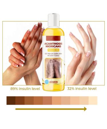 Extra Strong Peeling Oil - Chemical Exfoliant for Face & Body | Reduces Wrinkles Stretch Marks & Dead Skin - Buy Online on GoSupps.com