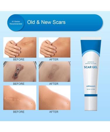 Aroamas Scar Silicone Gel 30g - Soften & Flatten Surgical Scars, Keloids, Stretch Marks - Medical-Grade Clinically Proven Formula - Buy Online on GoSupps.com