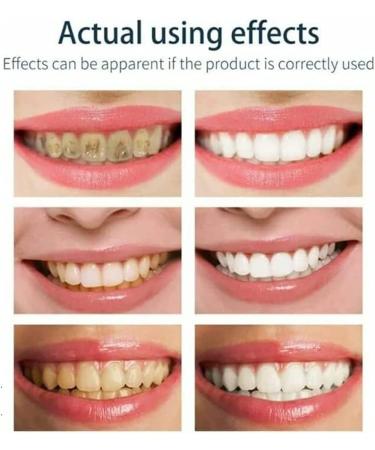 Saveuppro Teeth Whitening Mousse Dentifrice en mousse ultra fine Mousse de blanchiment des dents Nettoyage des dents Dentifrice Soins dentaires -50ML - Buy Online on GoSupps.com