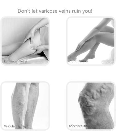 Buy Aciyd Elastic Leg Compression Stockings | Comfortable Durable Cuff for Varicose Veins & Edema Relief (23-32mmHg) - Black M - International Shipping Available - Buy Online on GoSupps.com