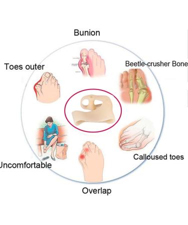 Bunion Corrector 1 Pair | Soft Breathable Hallux Valgus Correction Socks | Orthopedic Bunion Splint & Toe Separator | Foot Health Care Protector for Pain Relief | Men & Women - Buy Online on GoSupps.com