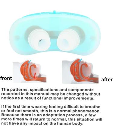 ZJchao Electric Intelligent Nose Vents Plugs - Anti Snoring Solution for Better Sleep - Blue - Buy Online on GoSupps.com