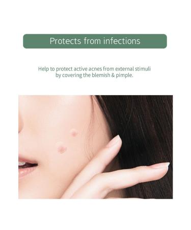 Buy Tea Tree Acne Spot Patches - Salicylic Acid Treatment for Blemishes | 105 Count | Fast International Shipping - Buy Online on GoSupps.com