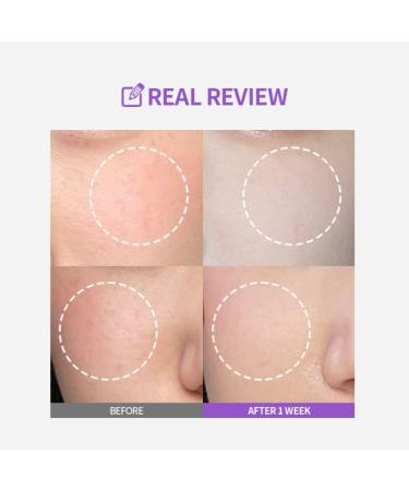 Meoru Podo Vita C Turn-over Ampoule - Niacinamide & Vitamin C | Korean Skincare | 1.01 fl. oz. | Shop Internationally - Buy Online on GoSupps.com