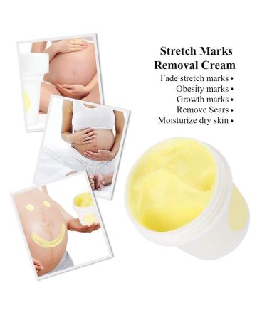 Stretch Strip Scar Cream | Anti-Strain Body Repair | Powerful Pregnancy Scar Removal - Buy Online on GoSupps.com