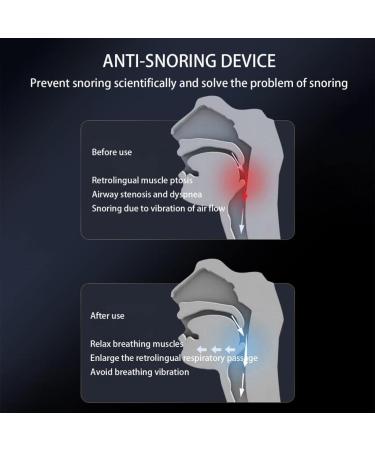 Mini Portable Electric Anti-Snoring Device for Home Use - Smart Snoring Solution for Men and Women - Stop Blocked Nostrils and Improve Sleep Quality - Buy Online on GoSupps.com