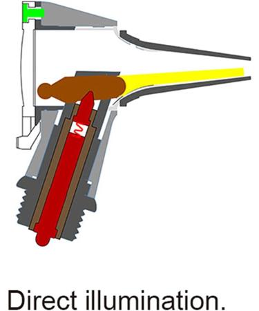 Premium Otoscope with Light - Ear Infection Detector Pocket Ear Exam Set for Nurses Kids Adults & Pets - Batteries Included (Black) - Buy Online on GoSupps.com