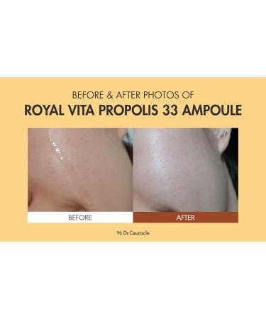Dr.Ceuracle Royal Vita Propolis 33 Ampoule (30ml / 1.01 fl. oz.) - Ultimate Glow and Nourish Vitamin Serum for Radiant Skin Formulated with Propolis and Royal Jelly Extract 1.01 Fl Oz (Pack of 1) - Buy Online on GoSupps.com