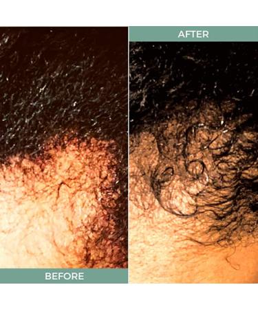 Recover Restore Gro Root Growth Elixir for 2b & 4c Hair - Rich Oil for Thinning Edges & Hair Loss - 4oz International Shipping - Buy Online on GoSupps.com