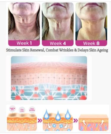 BEROZA 3Pcs REMEDIALX Collagen Firming Neck Cream - Anti-Aging Moisturizer for Skin Tightening & Wrinkle Reduction | Improve Elasticity & Reduce Neck Lines with Neck Firming Formula - Buy Online on GoSupps.com