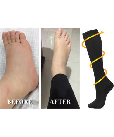 Losvcbcx Compression Socks for Men & Women | 7 Pairs 15-20 mmHg | Best Sports & Medical Stockings for Nurses | Air Travel | Mix Sizes L-XL - Buy Online on GoSupps.com