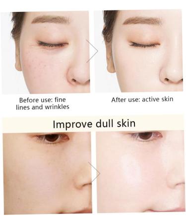 Pore Minimizer Correxion Hyaluronic Acid Night Serum Capsules Skin Moisturiser for Face - Buy Online on GoSupps.com