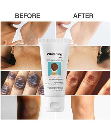Face and Body Whitening Cream Skin Lightening Cream Body Moisturiser for Skin Lightener Skin Bleaching & Whitening Cream for Dark Skin Body Whitening Cream for Elbows Underarm Inner Thigh Knees - Buy Online on GoSupps.com