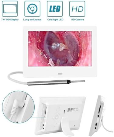 RKXKJ 7-Inch Ear Wax Removal Camera - 3.9mm Ear Scope with LED Light 2 Million Pixels - Safe for Children & Adults - Buy Online on GoSupps.com