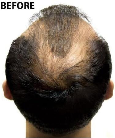 Super Million Hair - 15g Hair Fibres - No.67 Natural Blonde - Buy Online on GoSupps.com